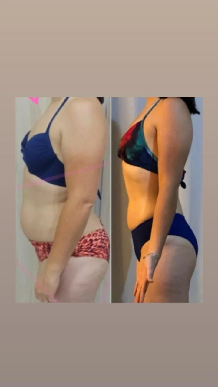 Resultado real antes e depois - Fabi Felintro personal trainer